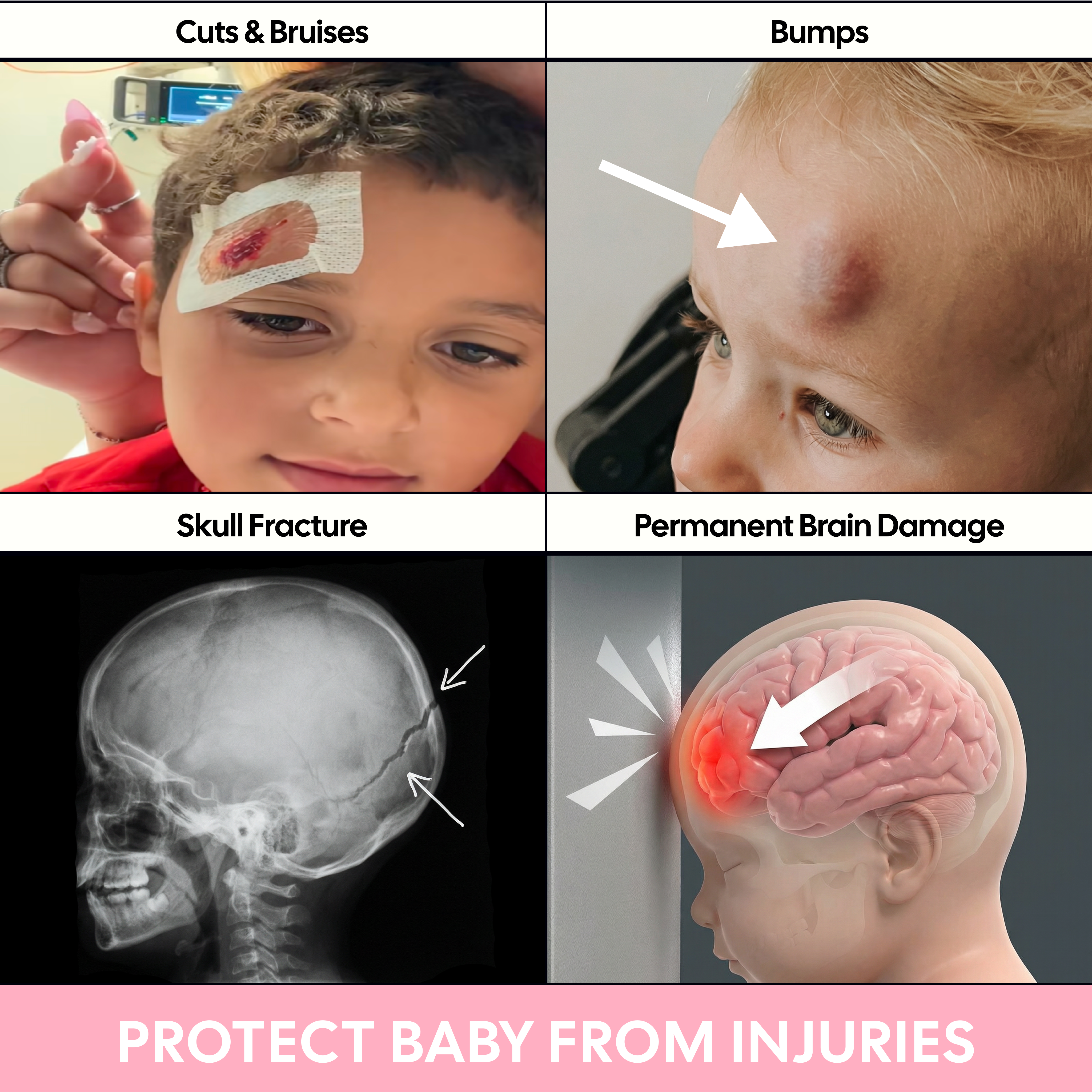 BabyGuard™ - Baby Head, Skull & Brain Safety Cap
